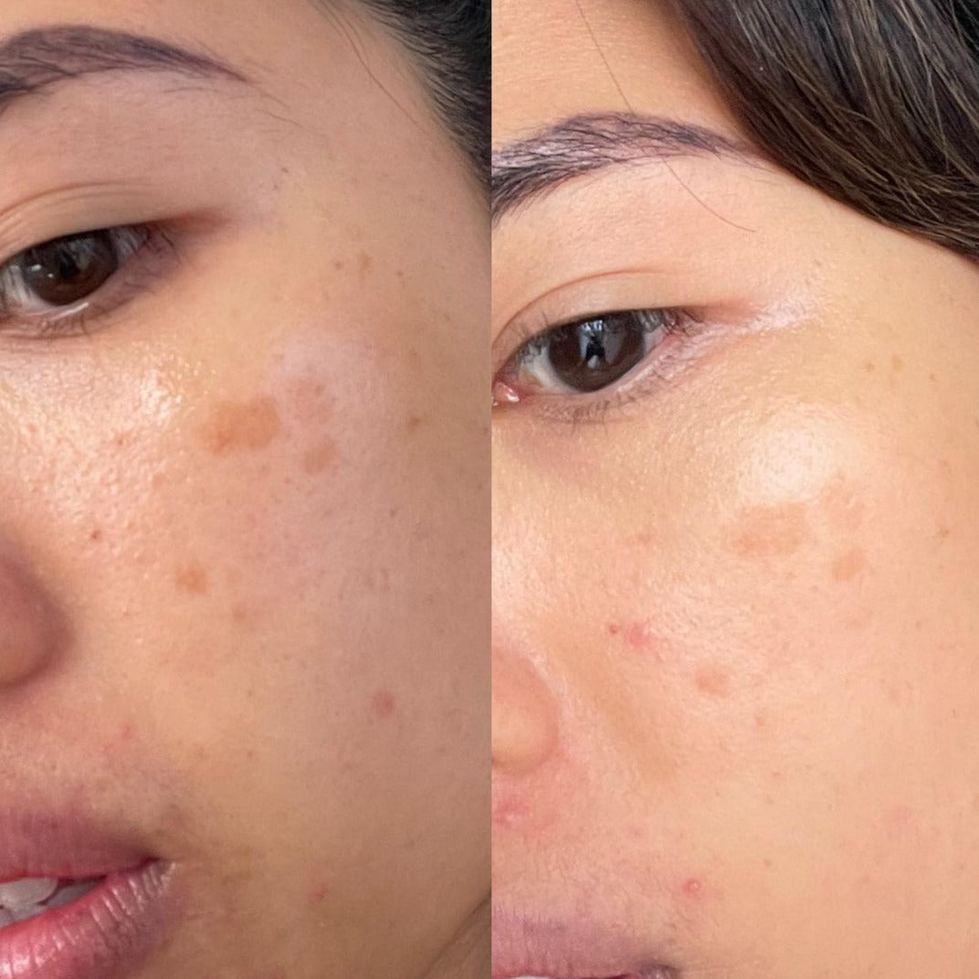 Vitamin C Booster Treatment, 5mL