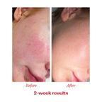 Vitamin C Booster Treatment, 5mL