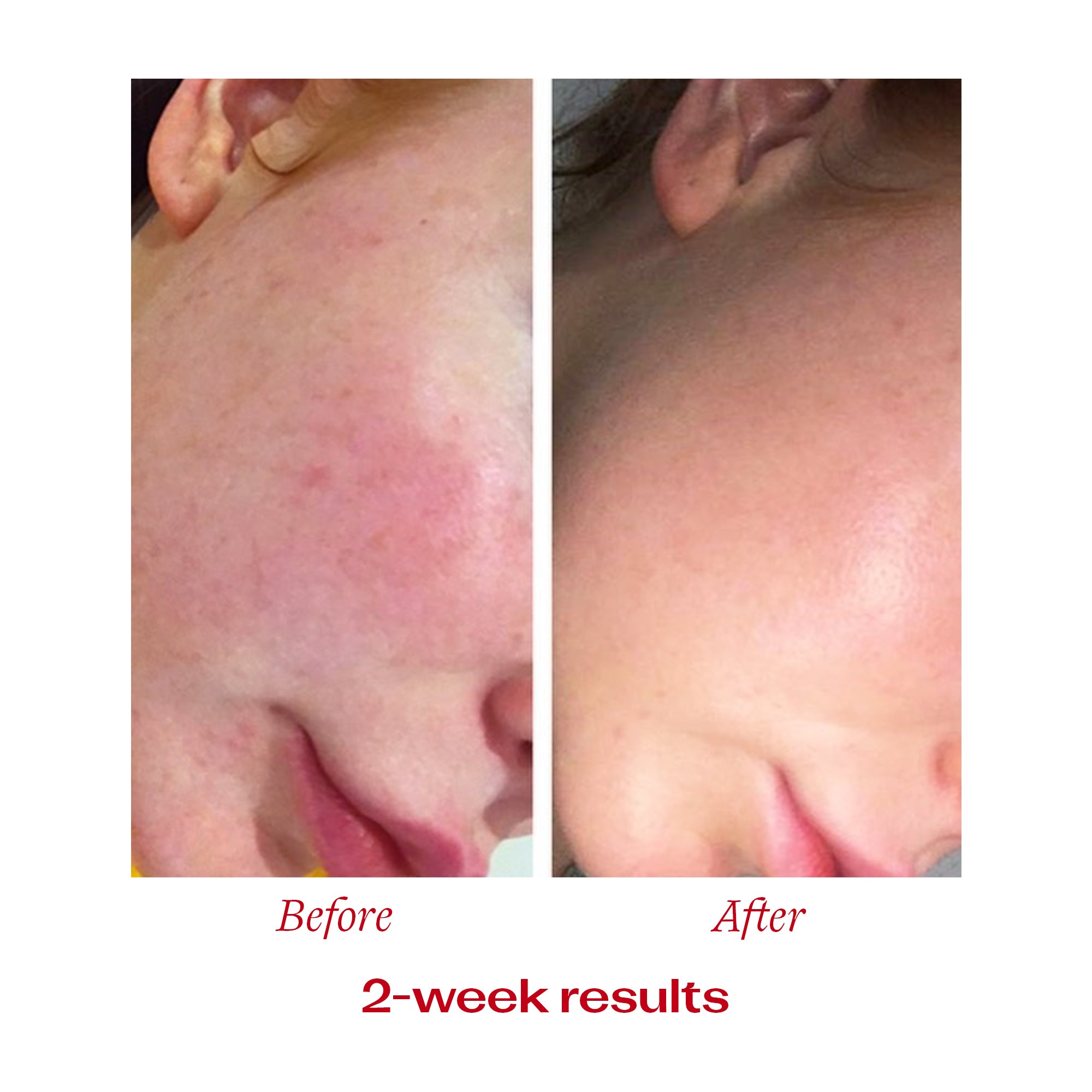 Vitamin C Booster Treatment, 5mL